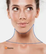 Cuello