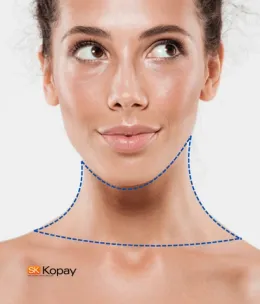 Cuello